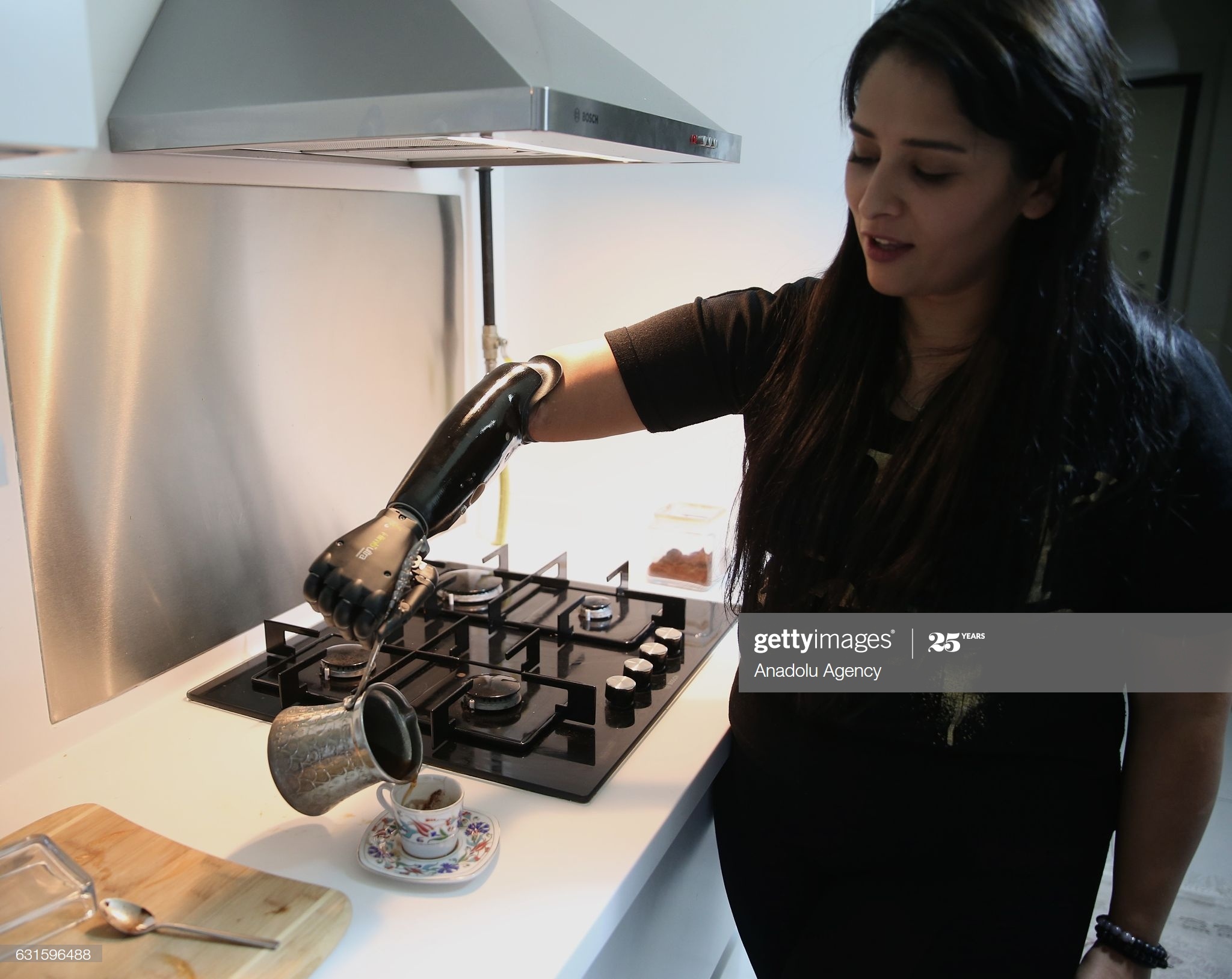 co gai voi canh tay bionic anh 2