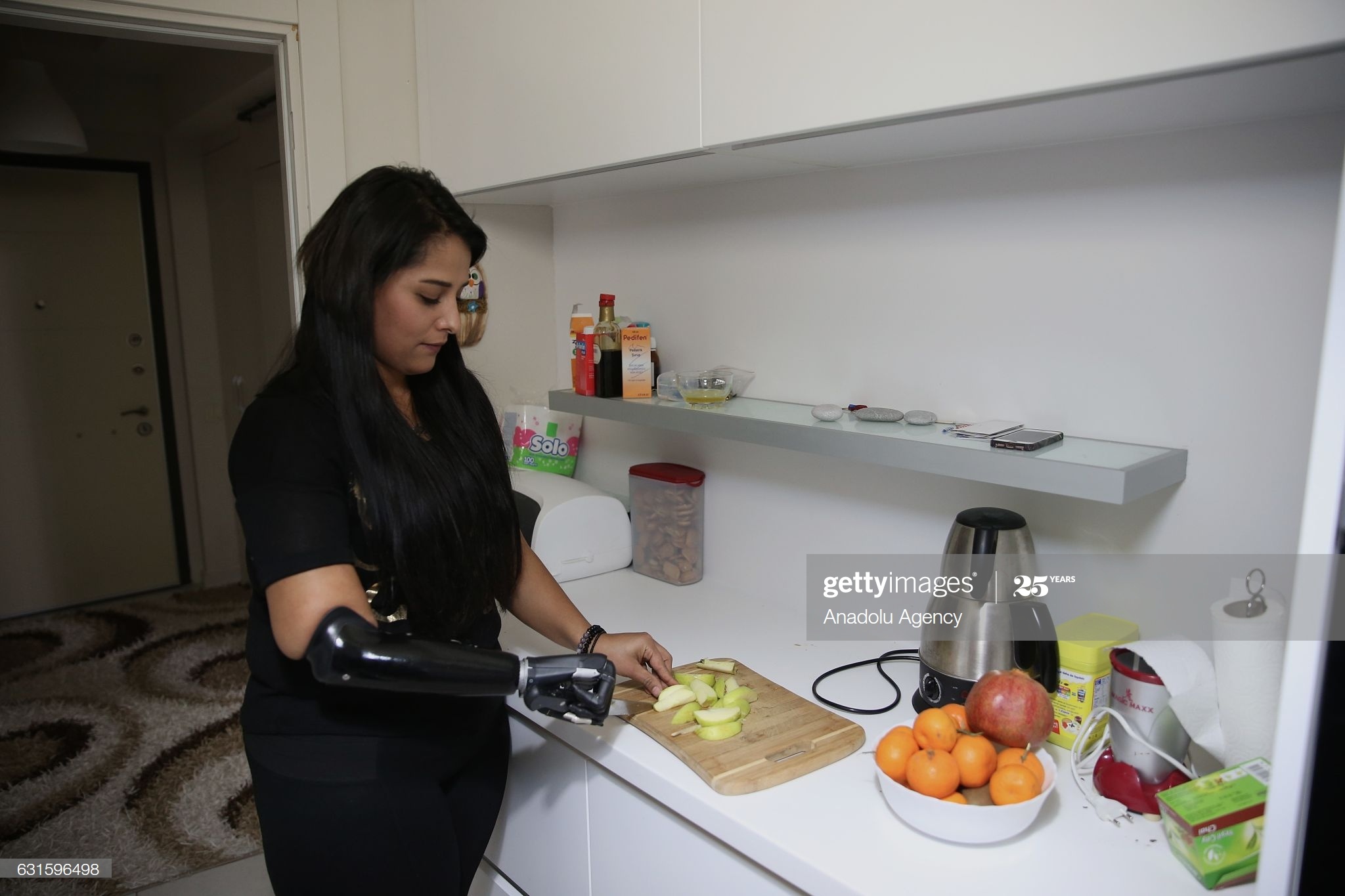 co gai voi canh tay bionic anh 3