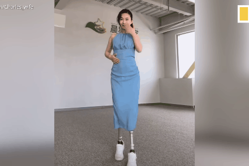 Co gai mat 2 chan sau tran dong dat van nhay mua, choi the thao hinh anh