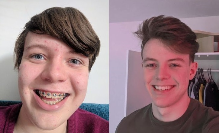 lot xac an tuong anh 8