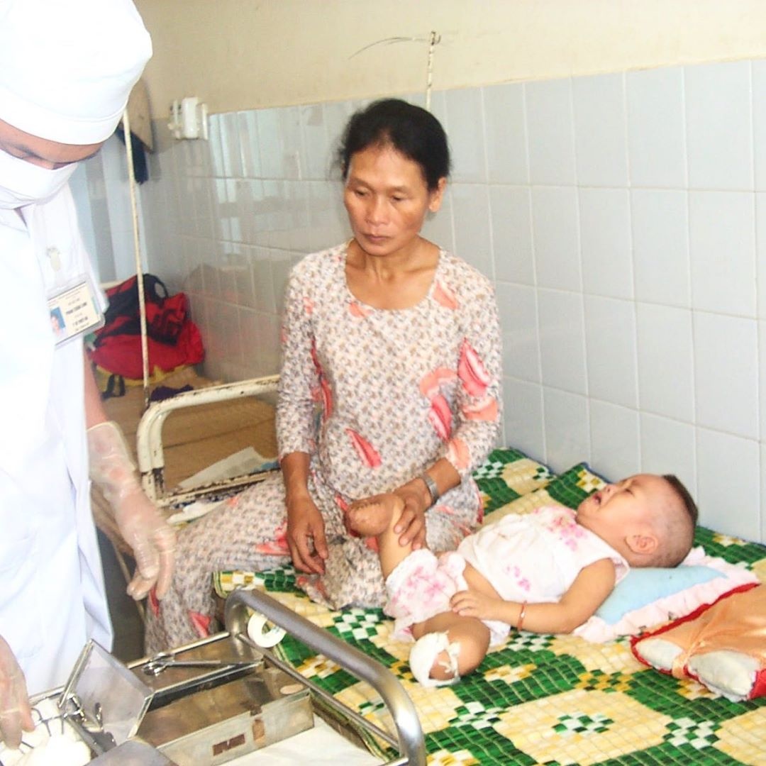 Co gai goc Viet mat 2 chan vi no bom anh 2