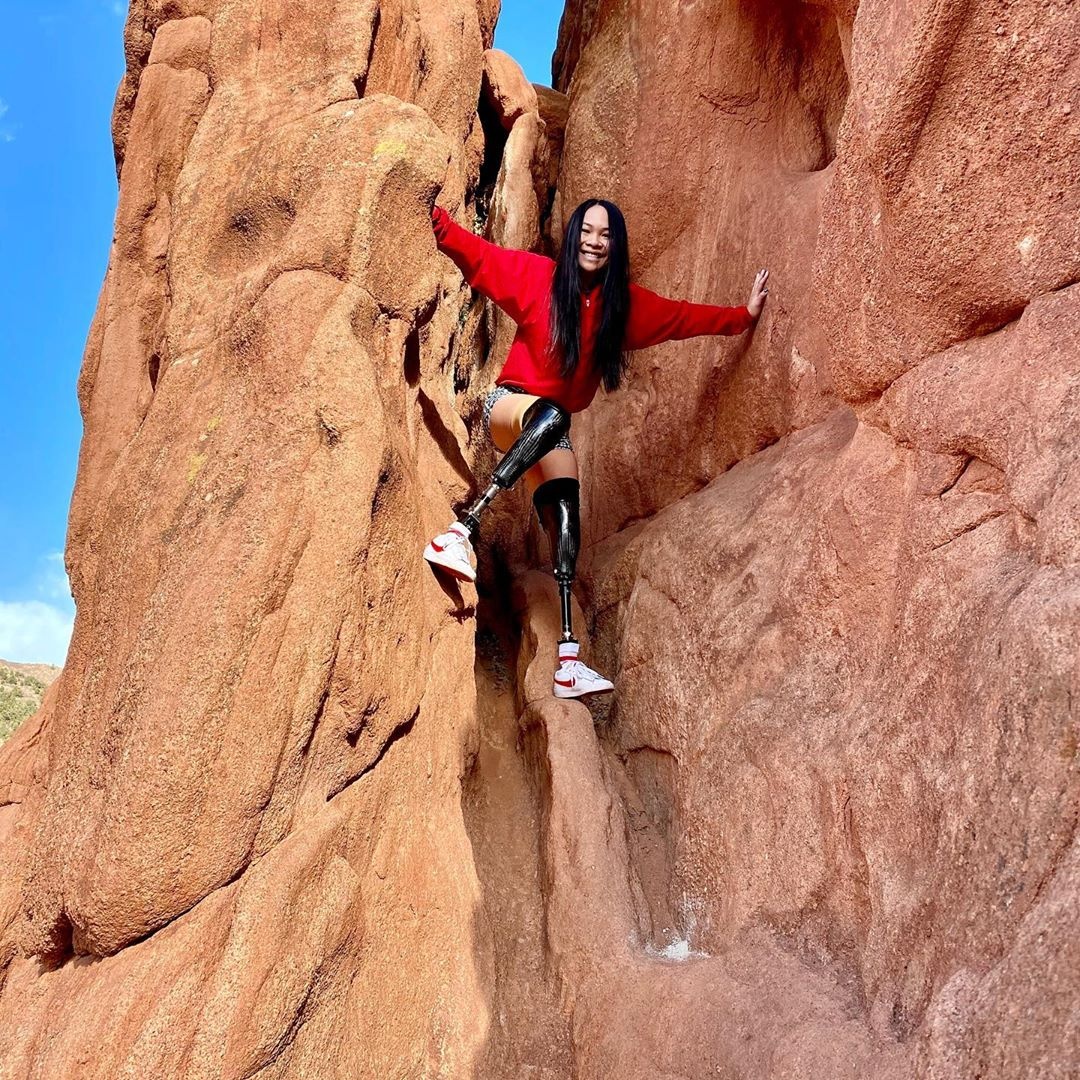 Co gai goc Viet mat 2 chan vi no bom anh 10