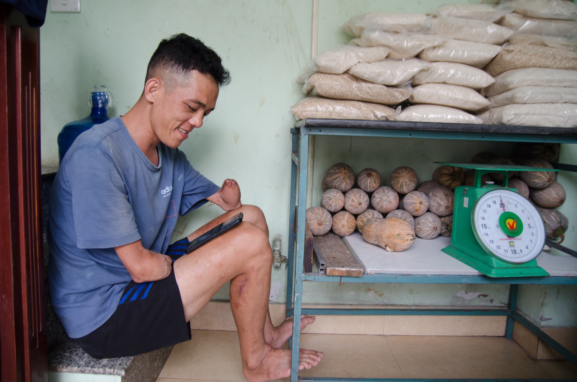 chang trai cut 2 tay sap cuoi vo anh 5