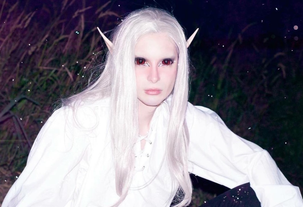 Chi 60.000 USD, phau thuat 32 lan de thanh ‘yeu tinh doi thuc’ hinh anh