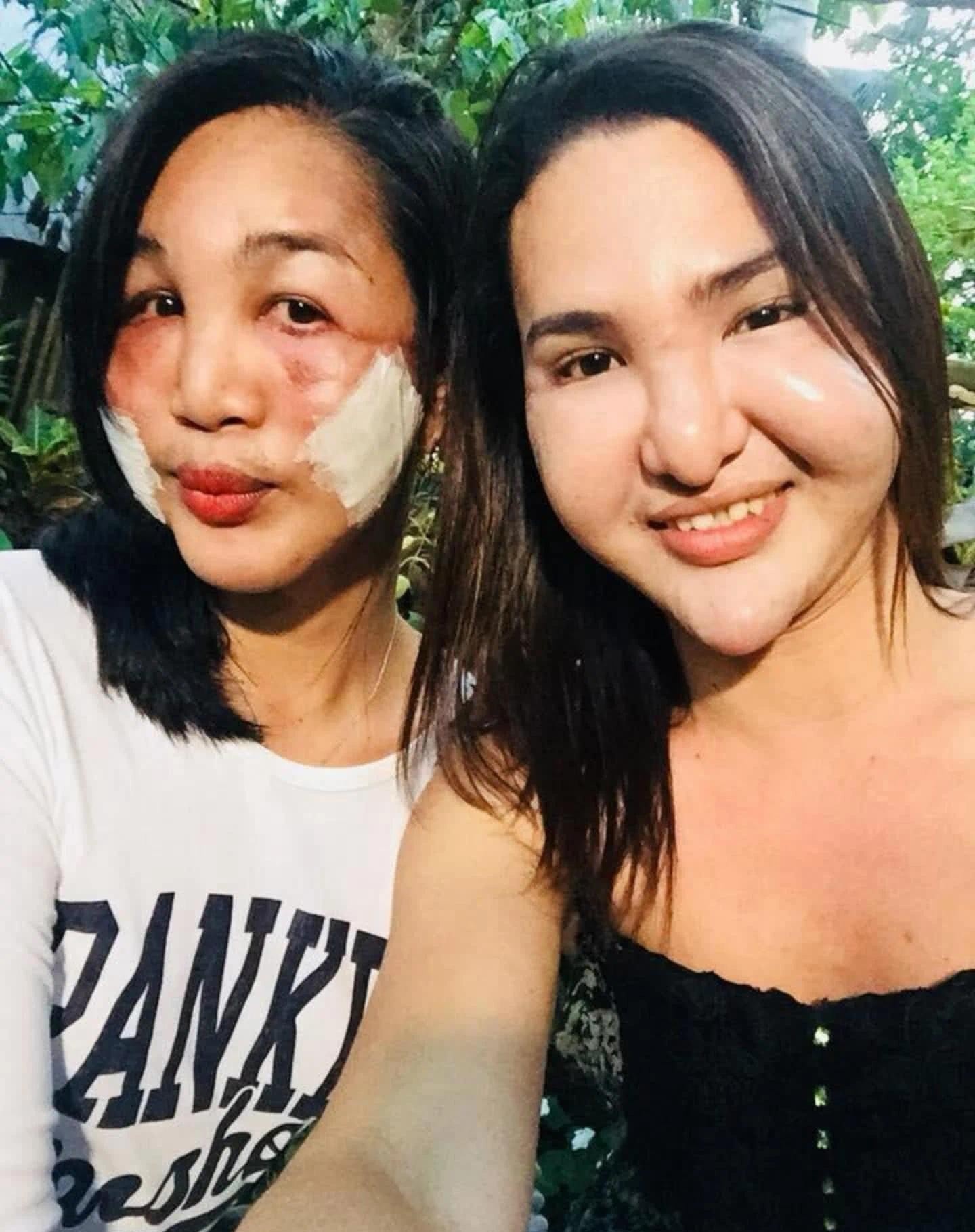 người mẫu chết vì hút mỡ ảnh 2 nguoi mau chet vi hut mo anh 2