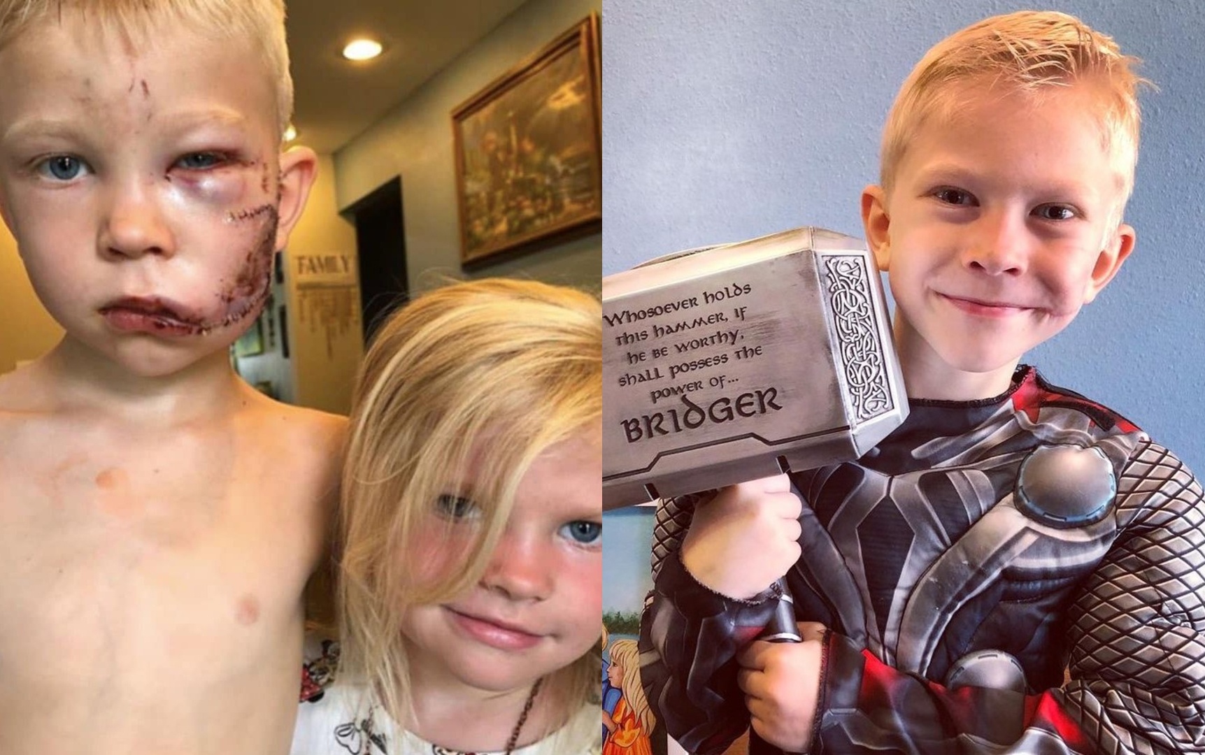 Cau be cuu em gai duoc chua tri mien phi hinh anh