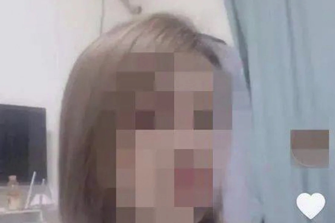 chet vi phau thuat tham my anh 1