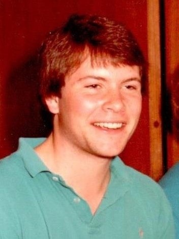 khuon mat bien dang sau khi cat bo khoi u anh 3