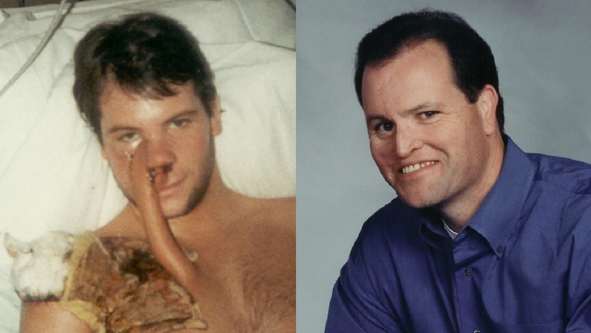 ‘Toi soc vi khuon mat bien dang sau khi cat bo khoi u’ hinh anh