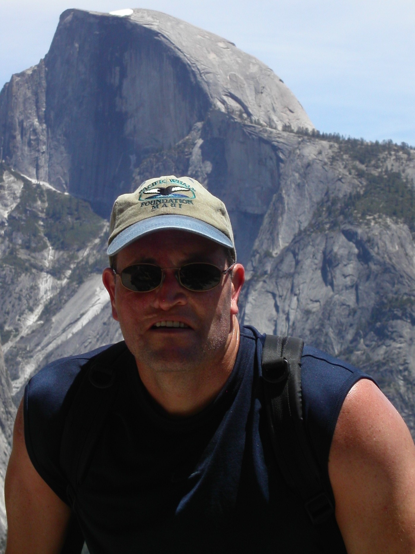 khuon mat bien dang sau khi cat bo khoi u anh 4