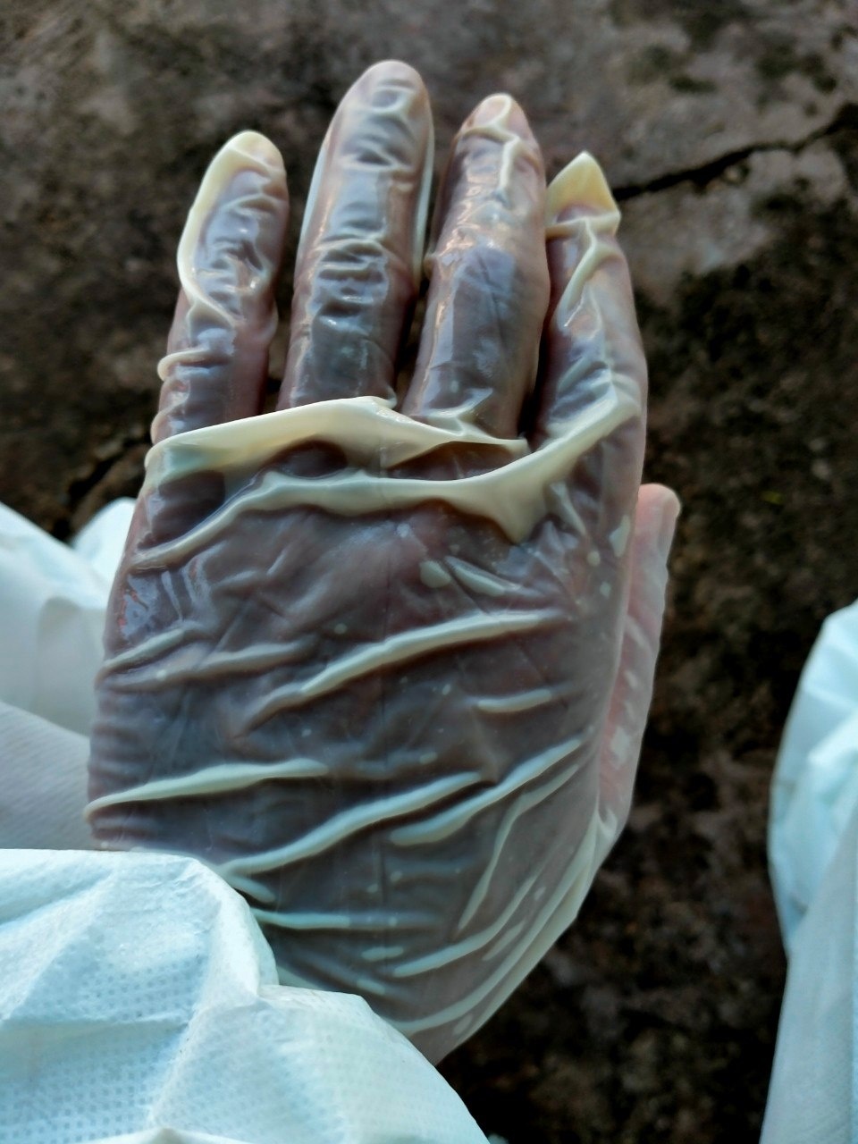 Hinh anh y bac si Dien Bien uot dam mo hoi anh 3