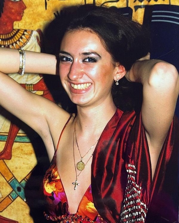 Người mẫu Ukraine nghiện tiêm filler đến biến dạng mặt ảnh 2 Nguoi mau Ukraine nghien tiem filler den bien dang mat anh 2