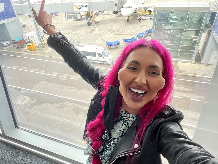 Người mẫu Ukraine nghiện tiêm filler đến biến dạng mặt ảnh 1 Nguoi mau Ukraine nghien tiem filler den bien dang mat anh 1