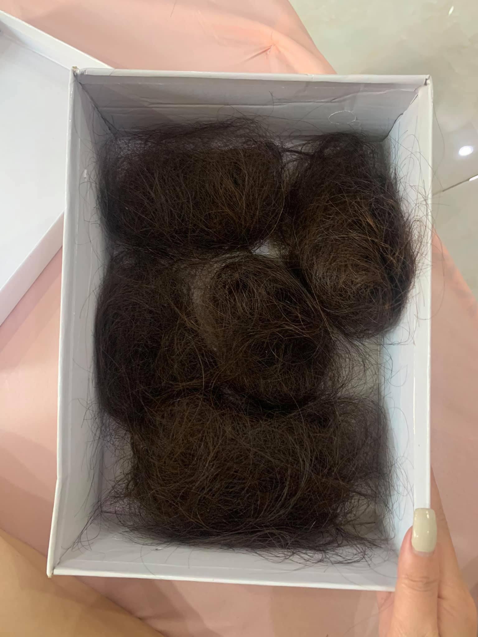 Nu dancer o TP.HCM phat hien mac ung thu o tuoi 26 anh 3