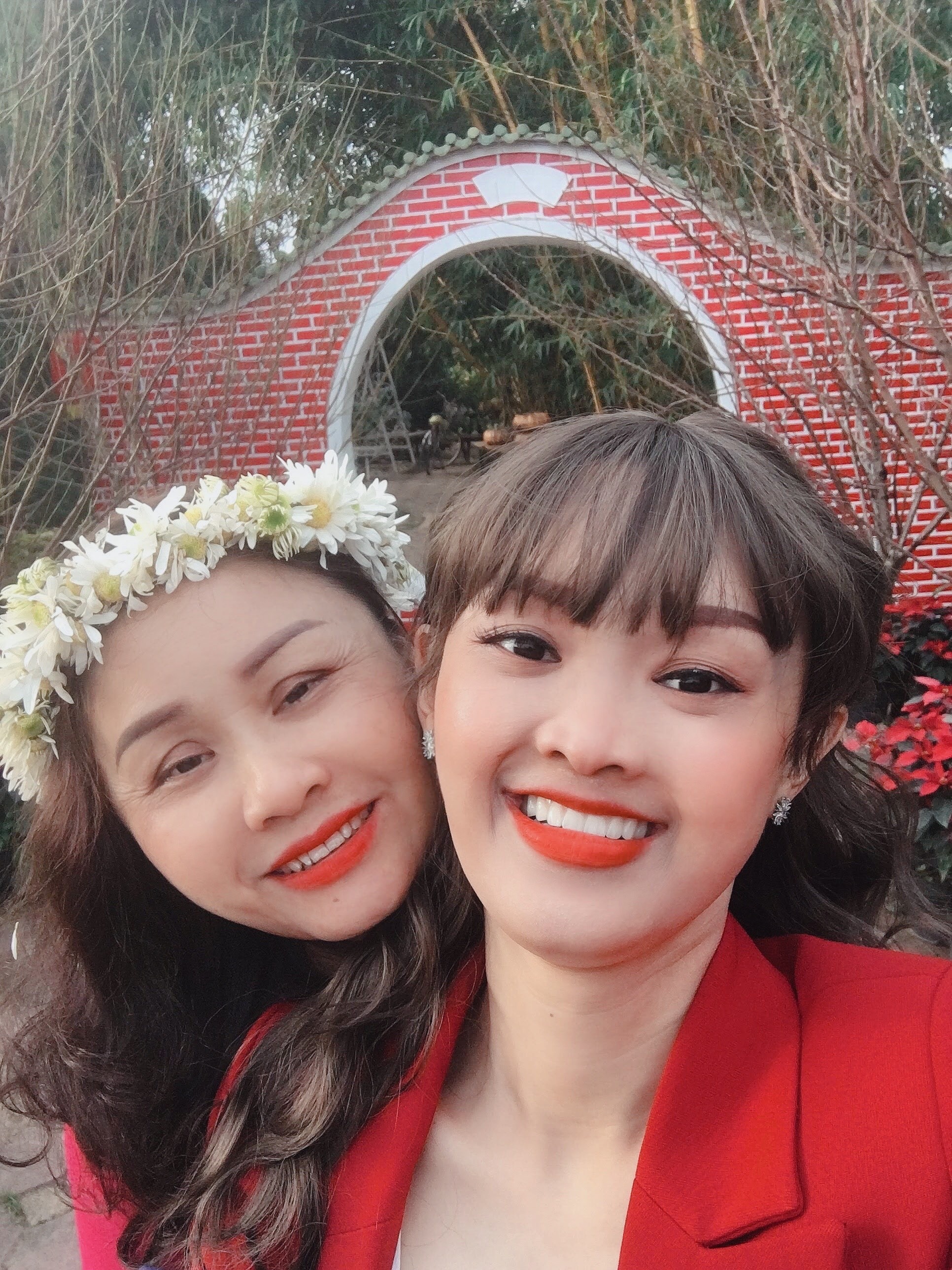 Cô gái không răng bẩm sinh ảnh 4 Co gai khong rang bam sinh anh 4