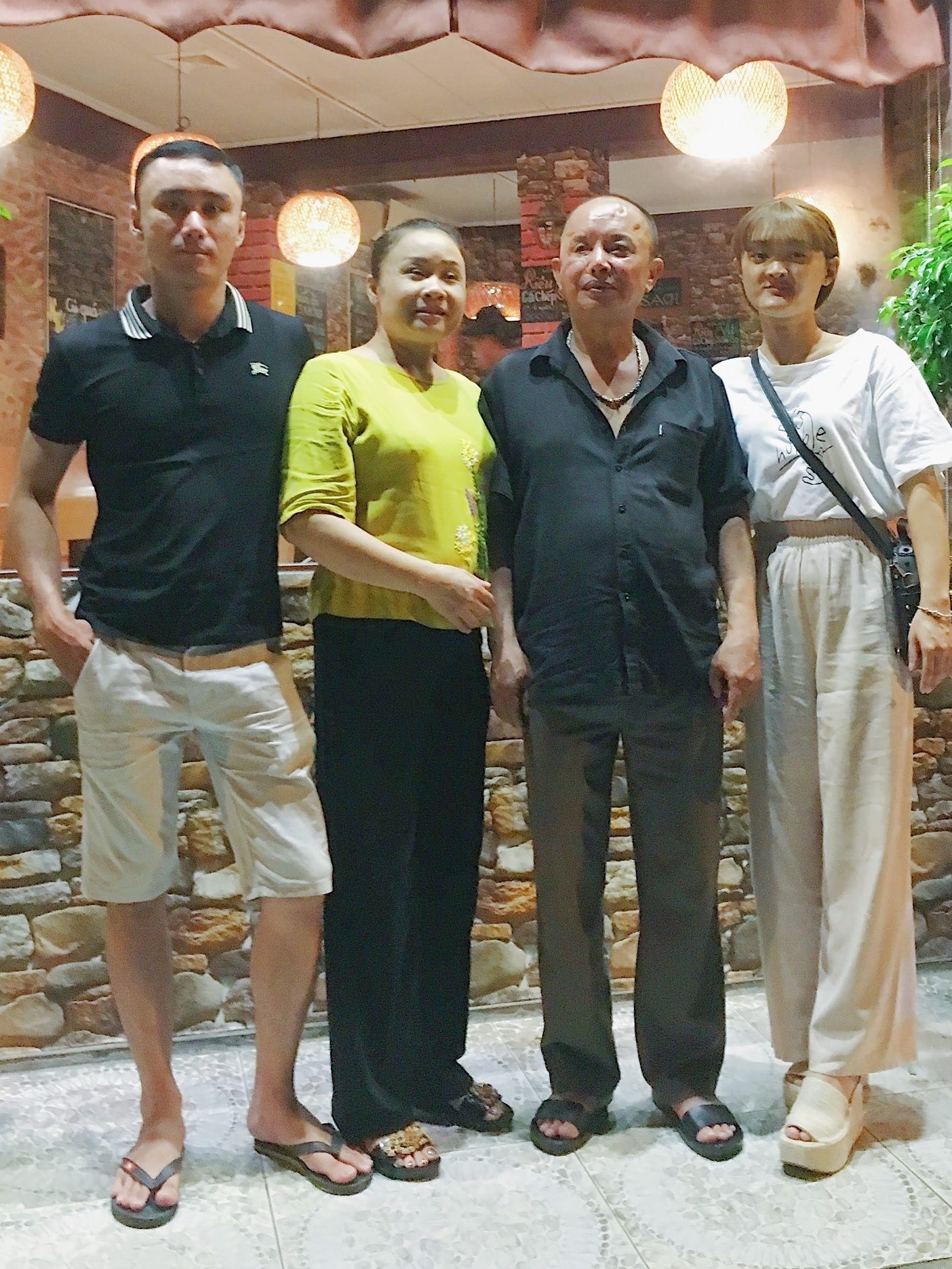 Cô gái không răng bẩm sinh ảnh 5 Co gai khong rang bam sinh anh 5