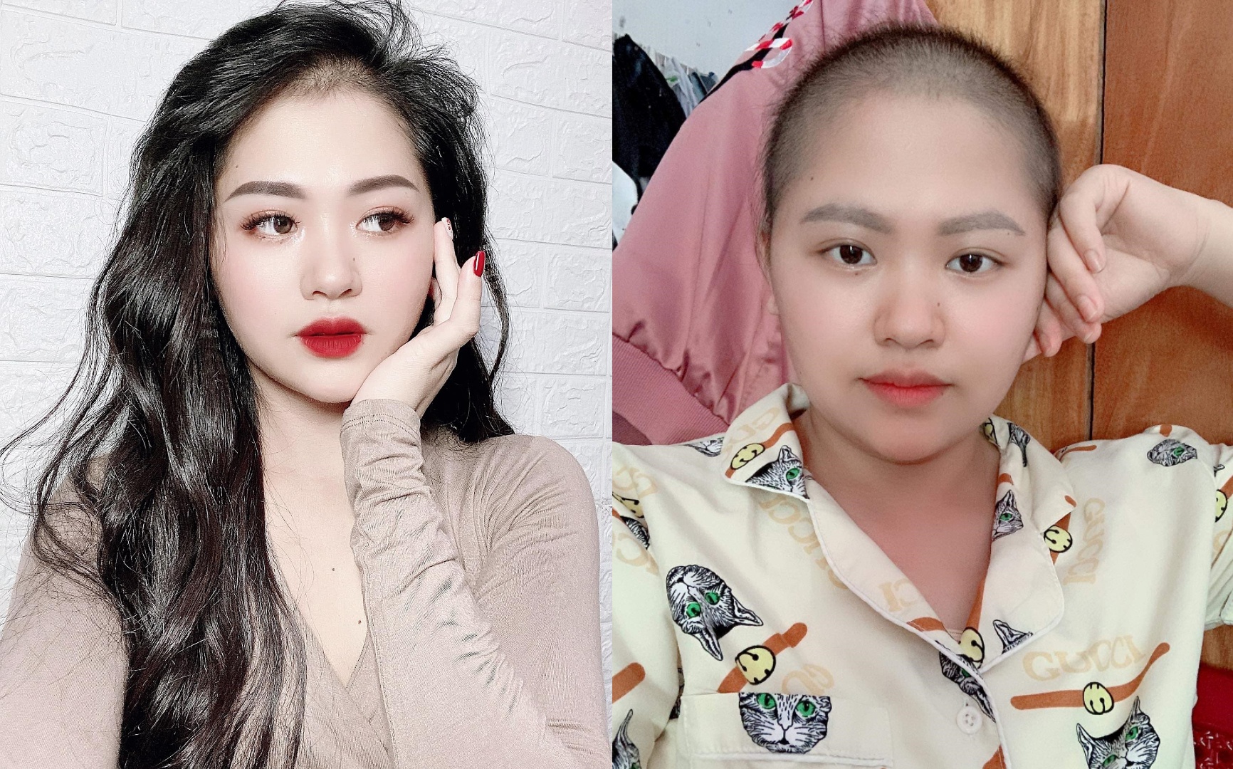 Nguoi me tre mac ket o TP.HCM 2 thang khi di dieu tri ung thu hinh anh