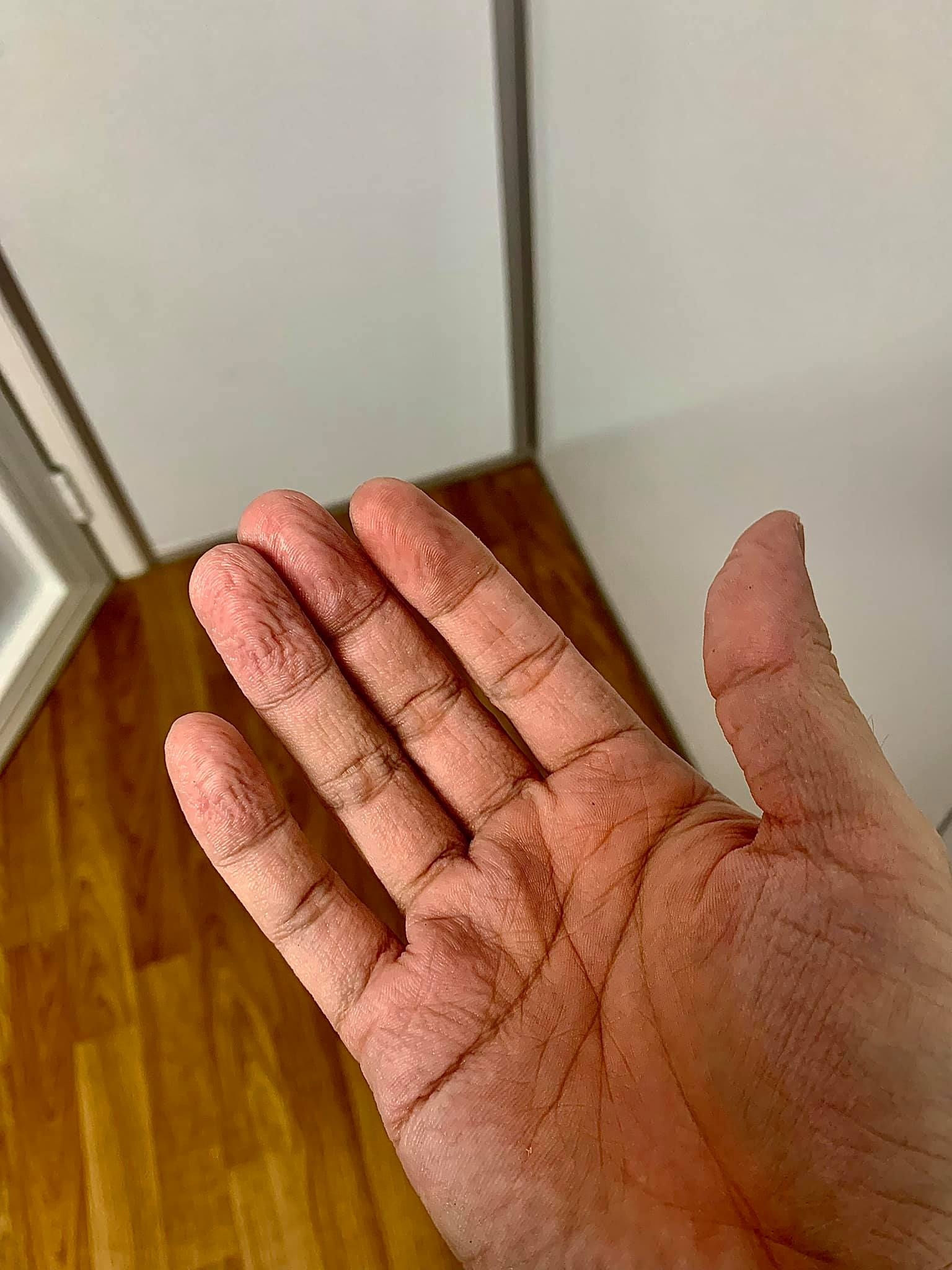 bác sĩ ở bệnh viện dã chiến ảnh 3 bac si o benh vien da chien anh 3