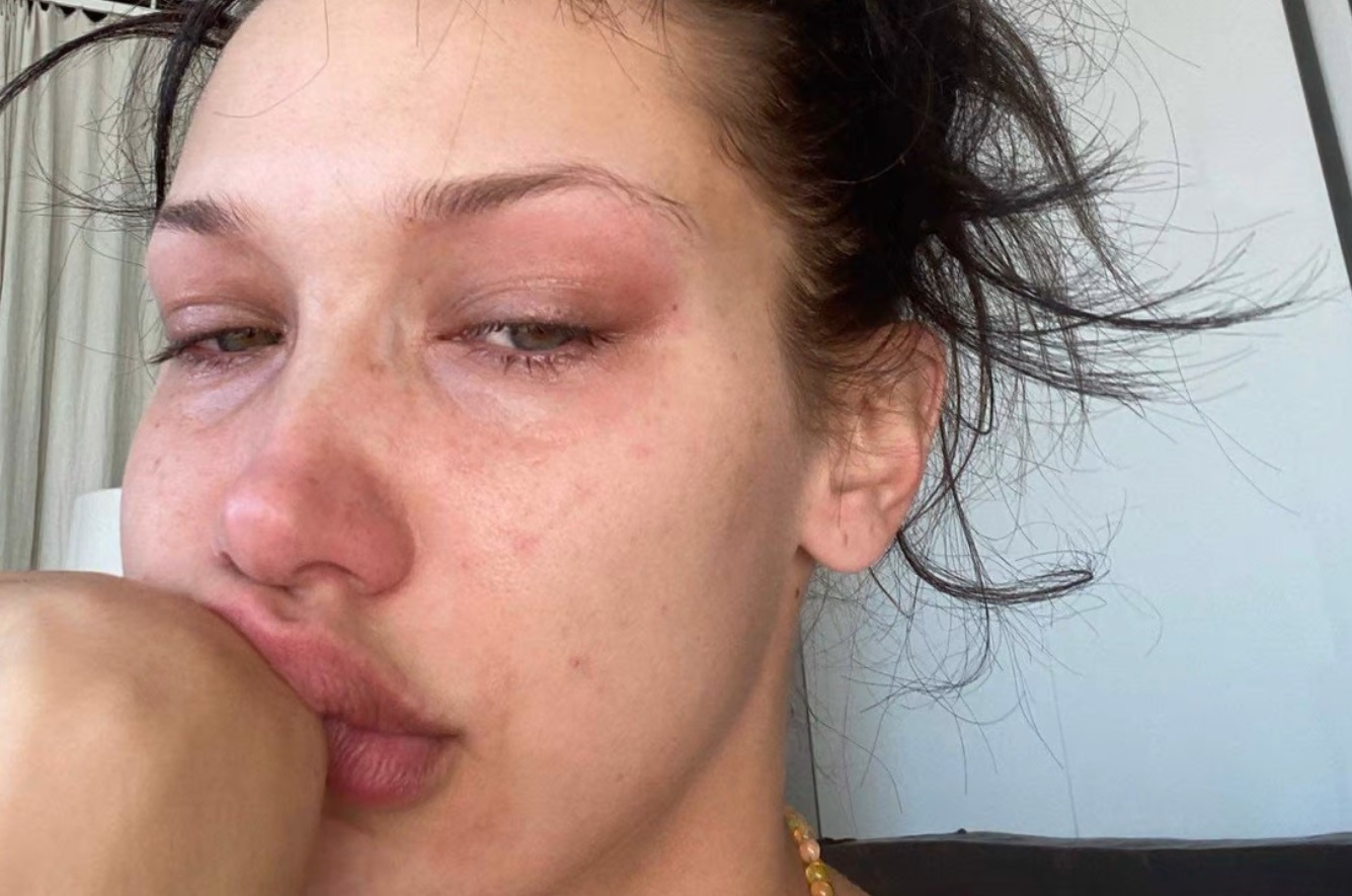 tram cam tu tu anh 7