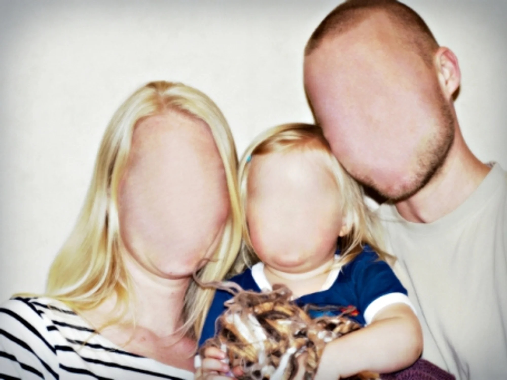 Hoi chung mu mat anh 3