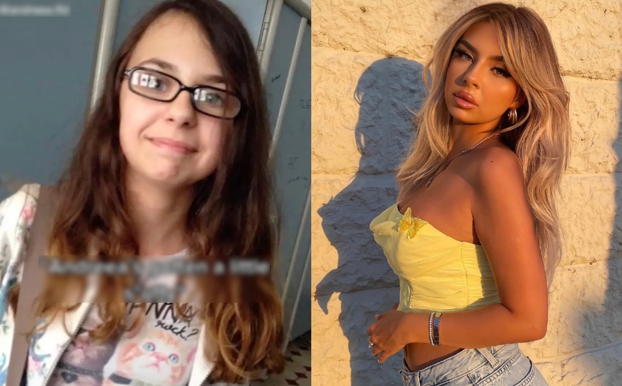 Co gai Anh bat ngo bi nem da vi trong qua khac 4 nam truoc hinh anh