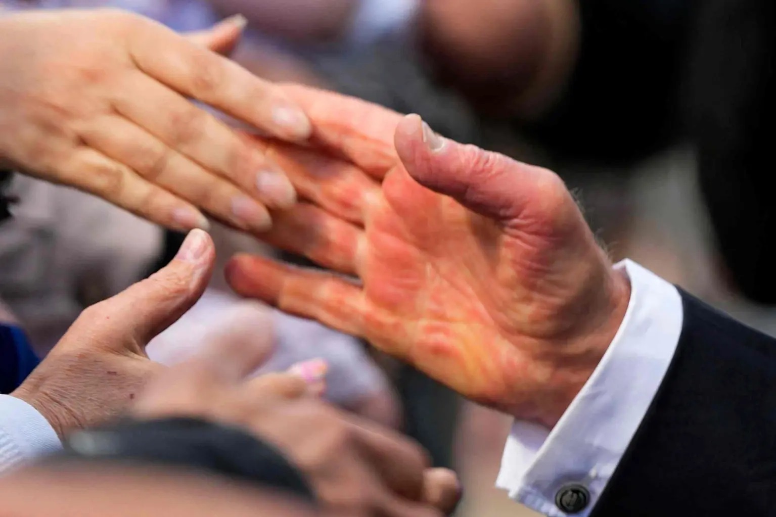 Ban tay do ung, sung phong cua Vua Charles III gay chu y hinh anh