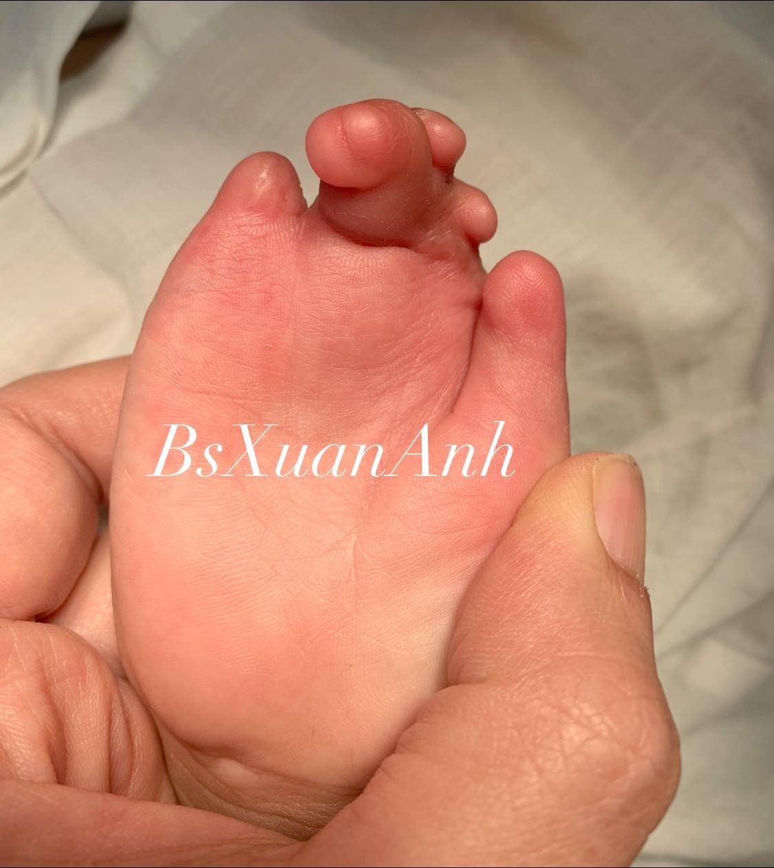 phẫu thuật chỉnh hình ảnh 1 phau thuat chinh hinh anh 1