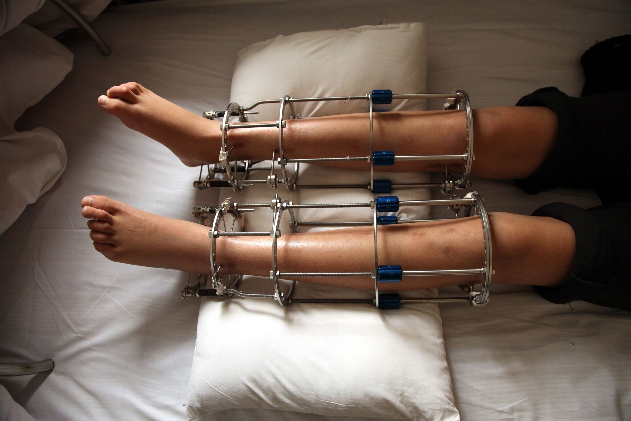 Dan ong di keo chan hinh anh