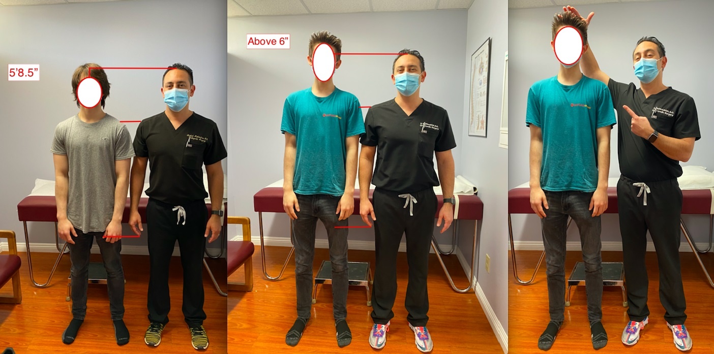 Dan ong keo chan anh 1