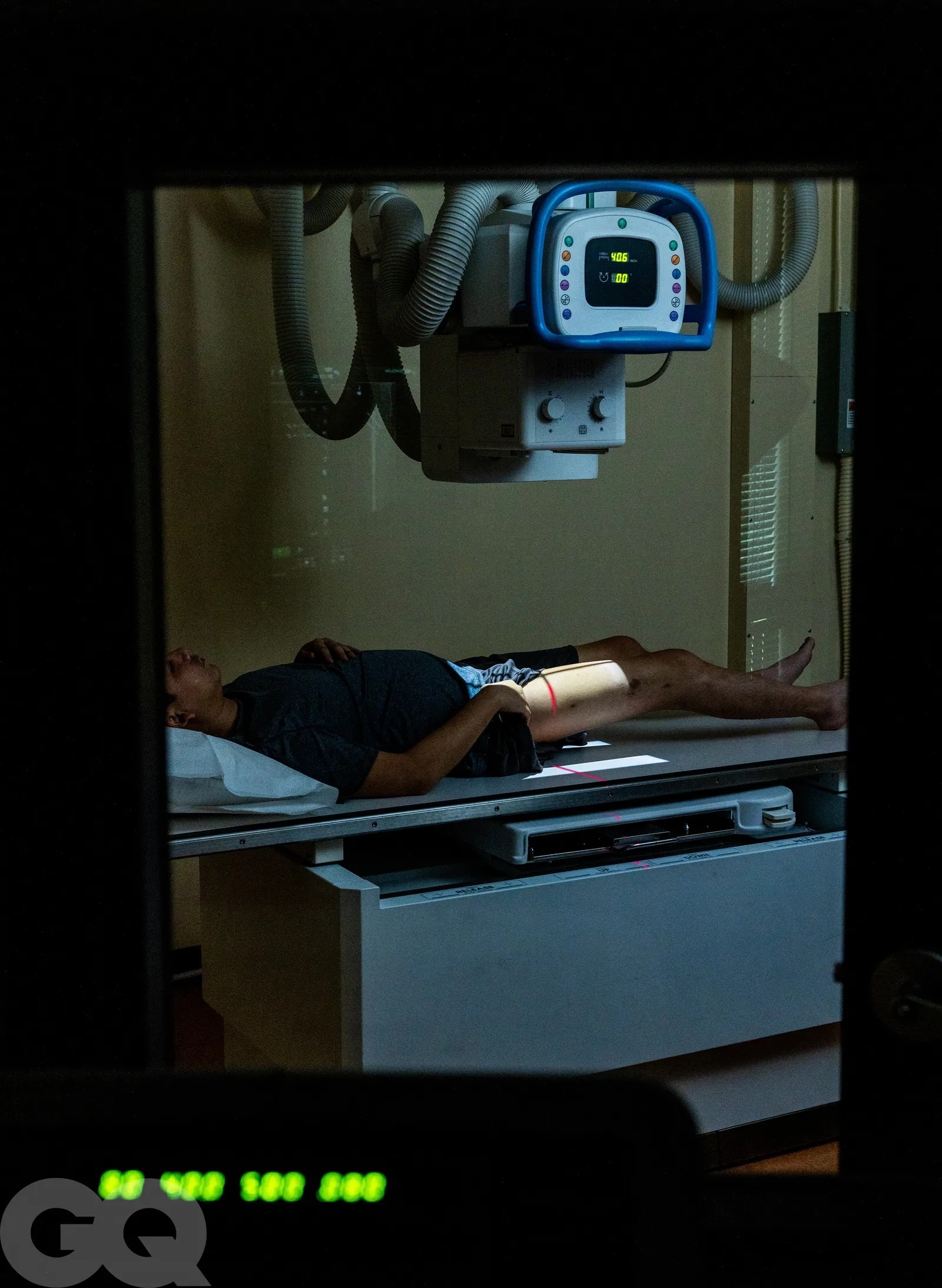 Dan ong keo chan anh 2