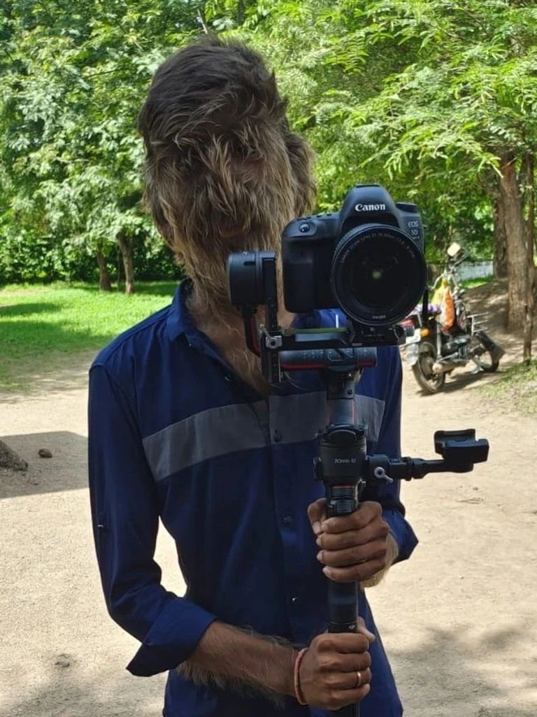 Benh nguoi soi anh 2