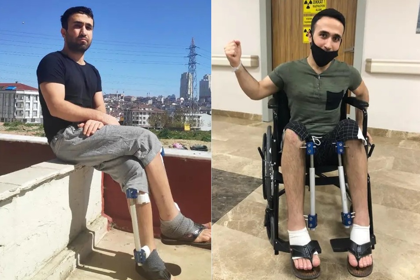 Doi doi khi keo dai chan 13 cm hinh anh