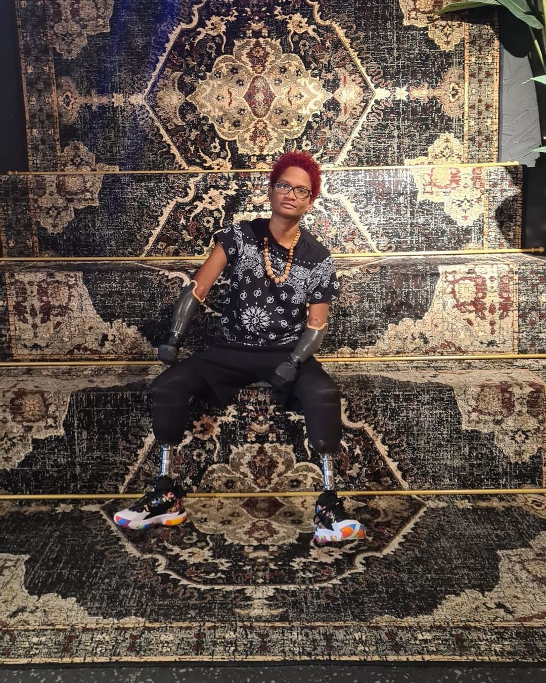 Bị cắt cụt tứ chi ảnh 2 Bi cat cut tu chi anh 2