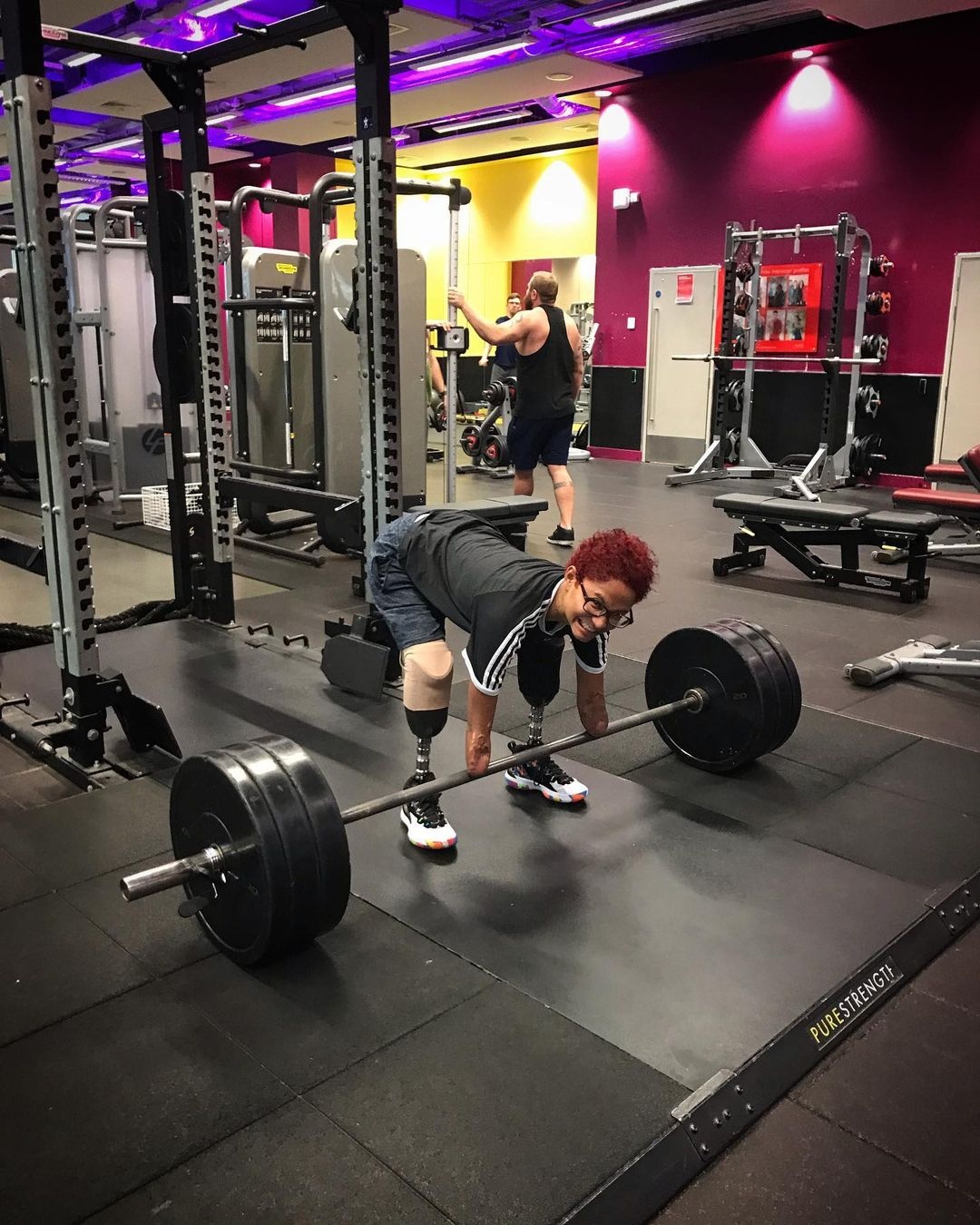 Bị cắt cụt tứ chi ảnh 1 Bi cat cut tu chi anh 1