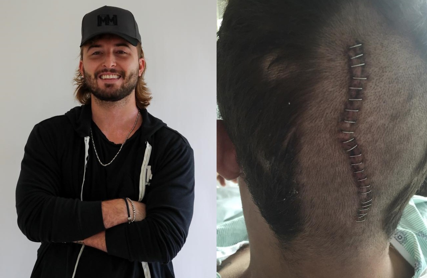 Chang trai My suyt mat mang sau mot cai hat hoi hinh anh