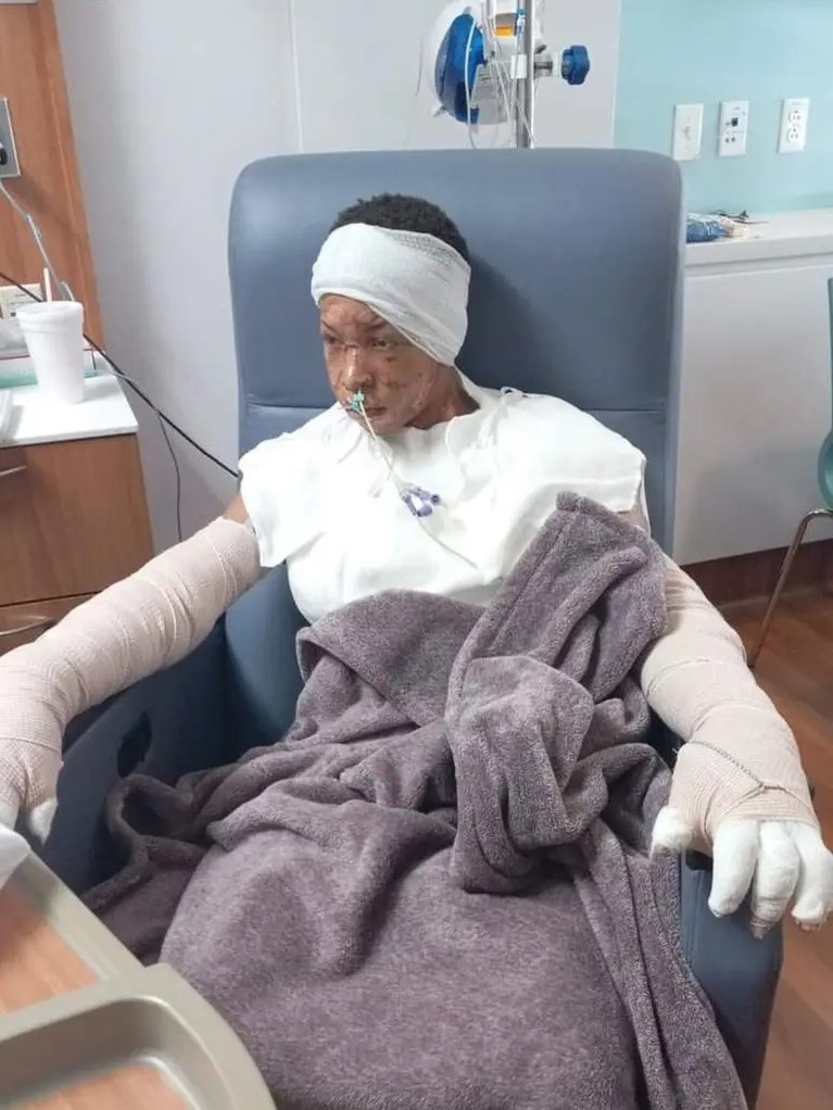 Bi bong vi du trend anh 2