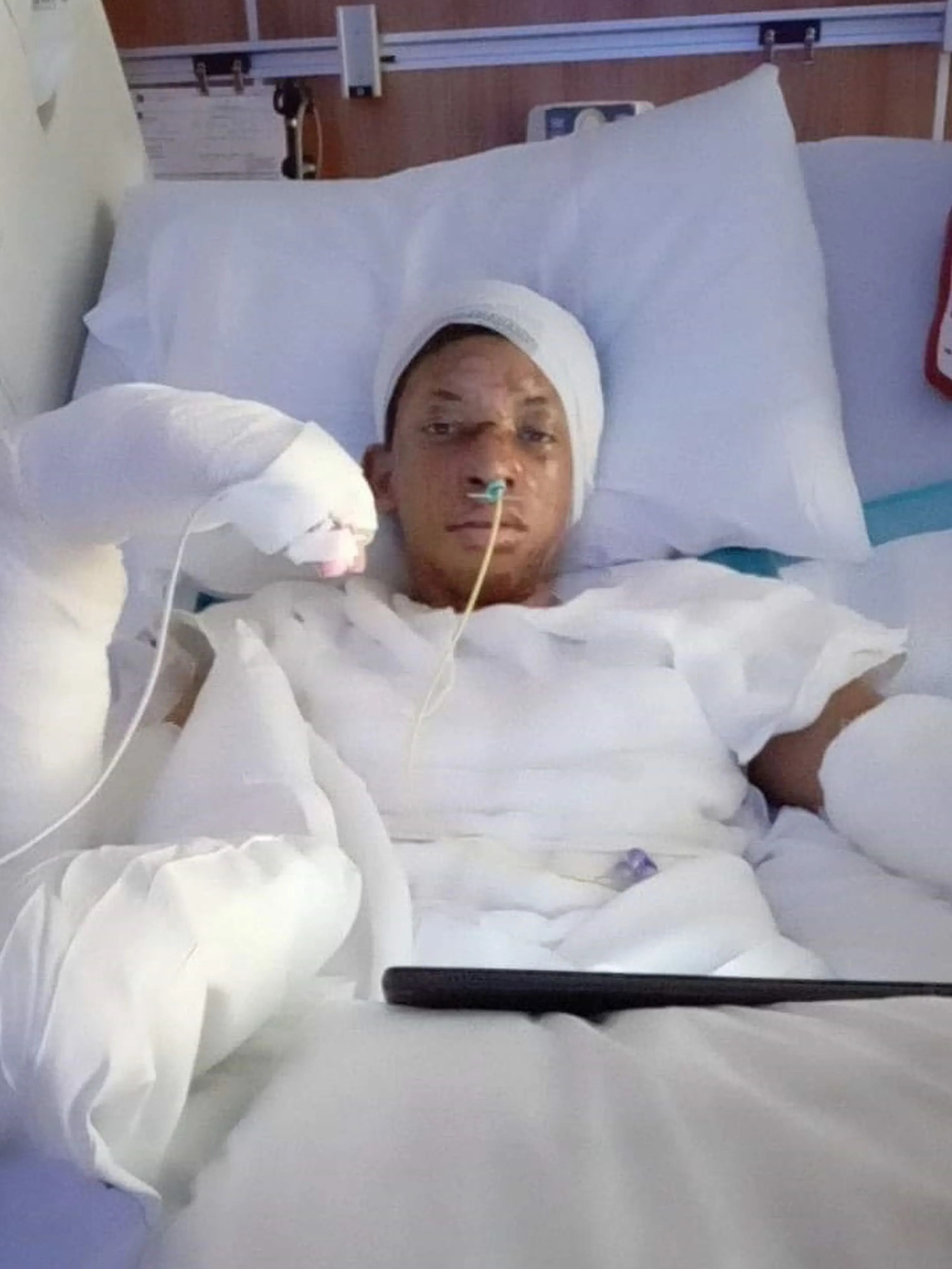 Bi bong vi du trend anh 1