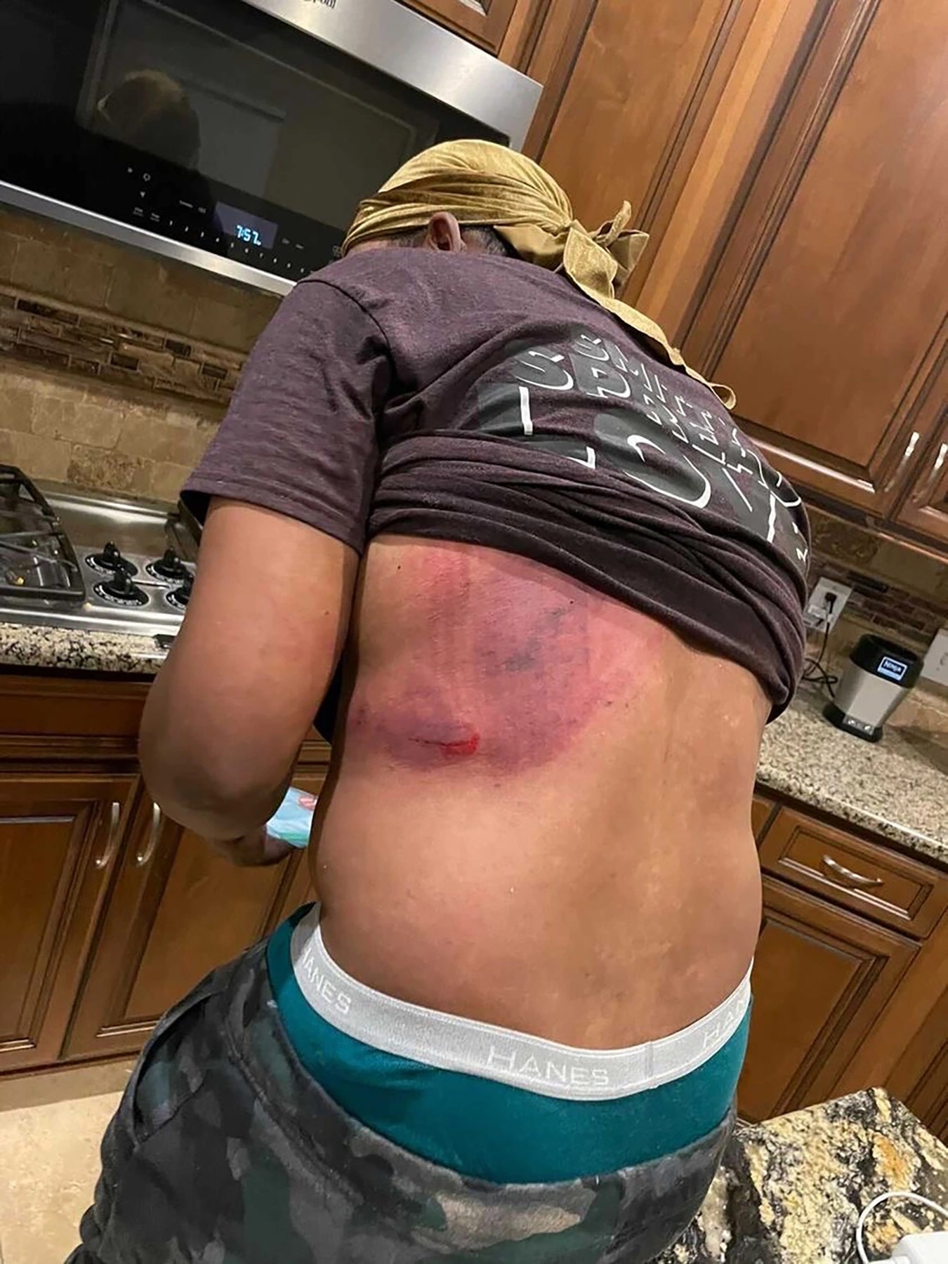 Trò đùa TikTok điên rồ ảnh 3 Tro dua TikTok dien ro anh 3