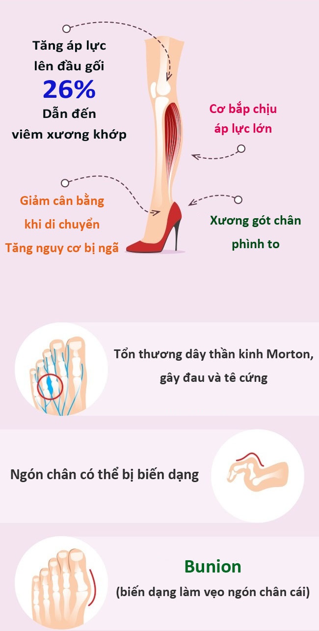 Giam thieu tac hai di giay cao got anh 1