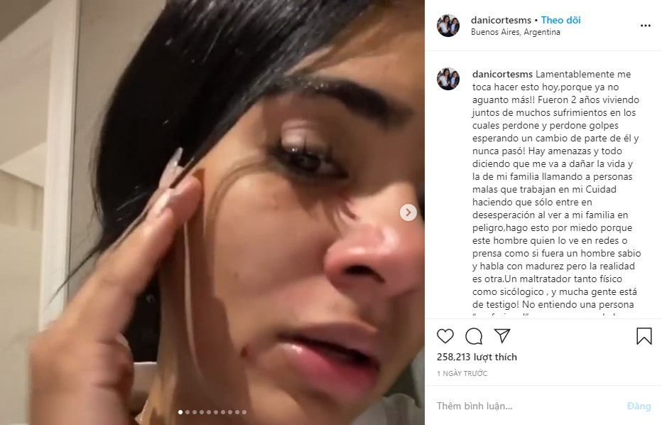 Cau thu Colombia bao hanh ban gai anh 1