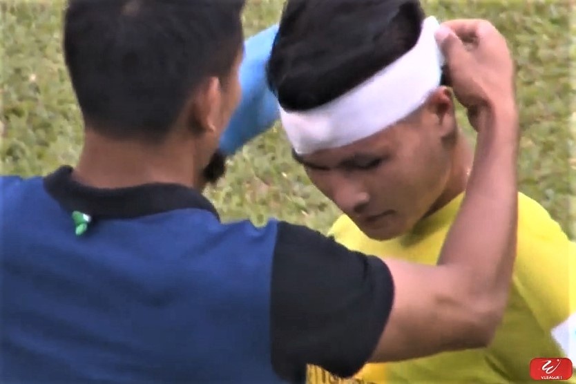 Quang Hai chay mau dau sau pha va cham voi Tien Linh hinh anh