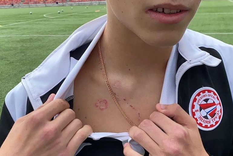 Thu mon Nga bi set danh anh 1