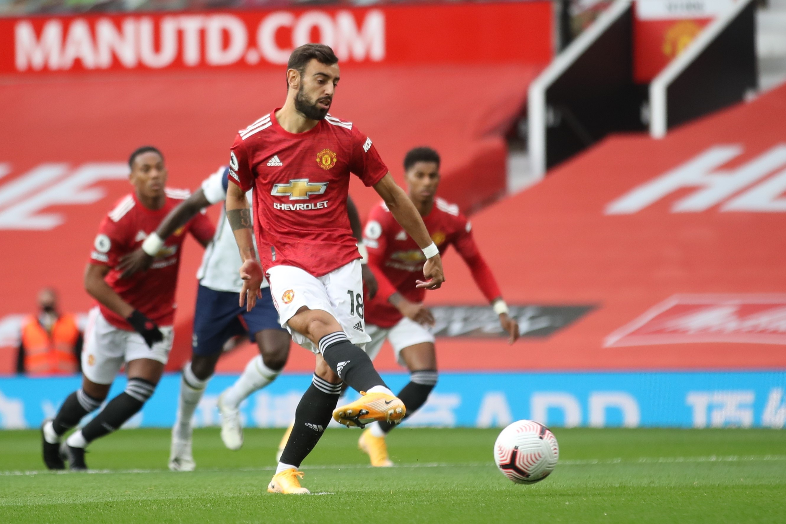 MU thua Tottenham anh 1