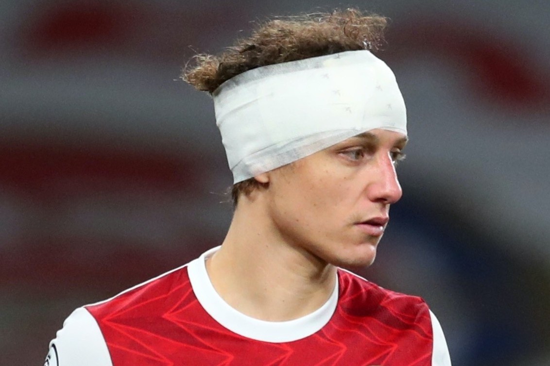 Arsenal tro lai thoi ky khung hoang 'hau Wenger' hinh anh