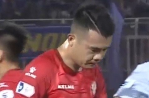 Hoang Thinh khoa trang ca nhan sau pha lam Hung Dung gay chan hinh anh