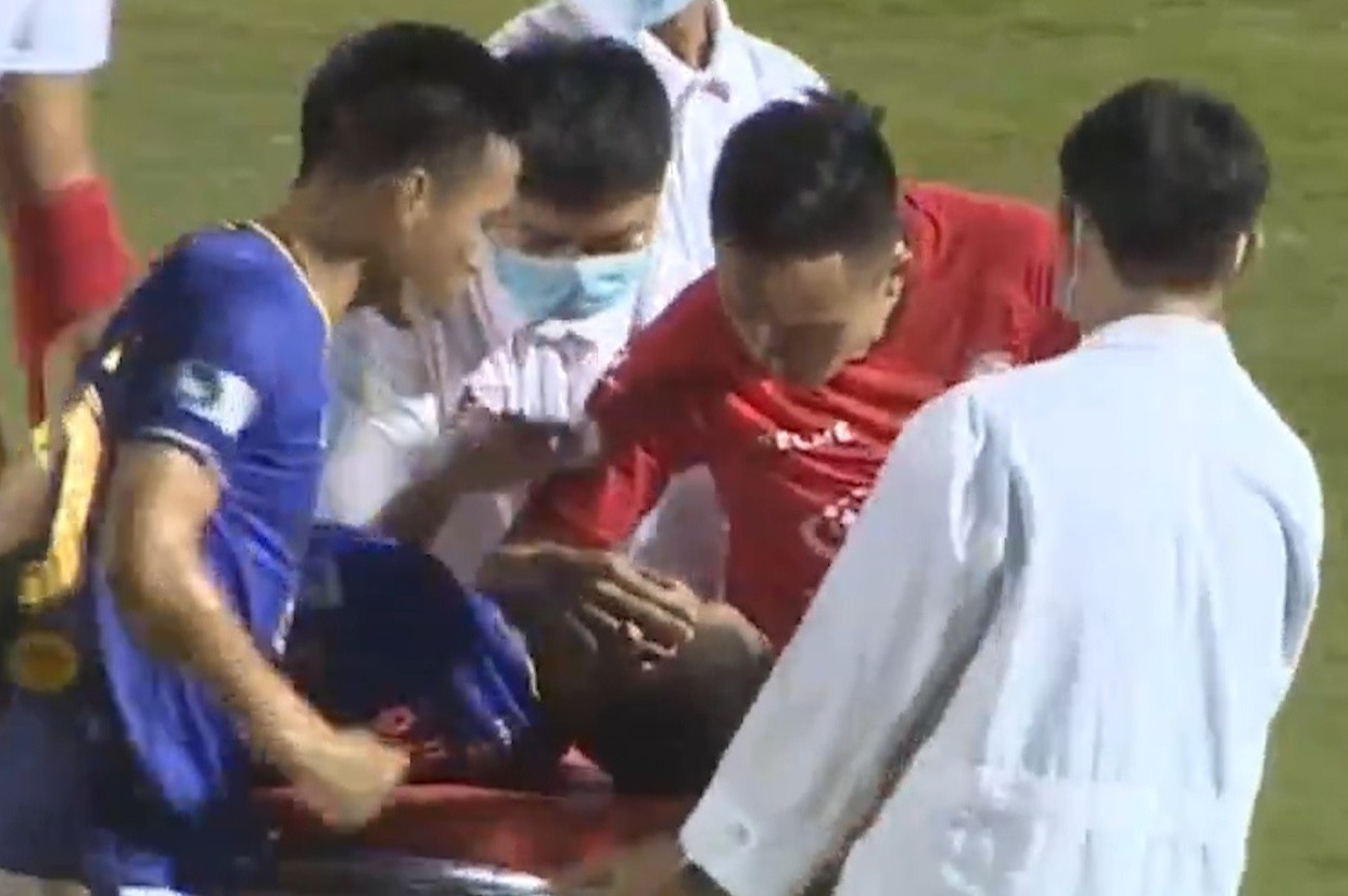 Cu xoac bong khien Hung Dung gay chan hinh anh