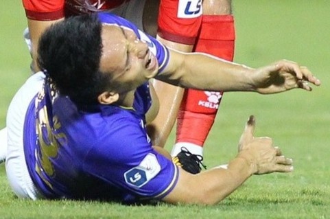 Duy Manh: 'Toi thay Hung Dung keu rat to' hinh anh