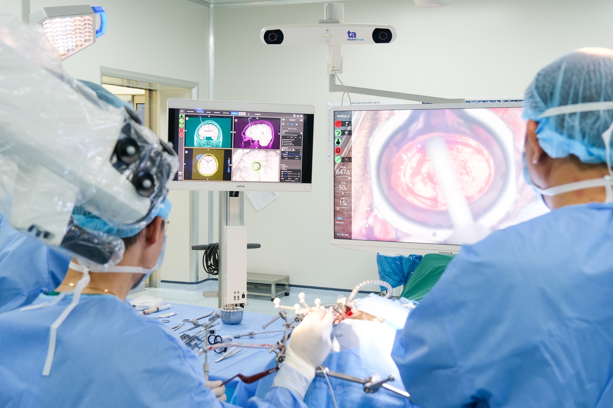 Video - Bac si tien hanh mo nao bang robot Modus V Synaptive hinh anh