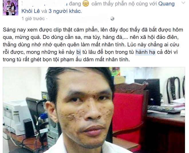 Bé trai bị hành hạ ở Campuchia ảnh 2 Be trai bi hanh ha o Campuchia anh 2