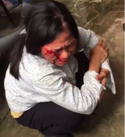 Hậu quả của chiêu trò câu like ảnh 2 Hau qua cua chieu tro cau like anh 2